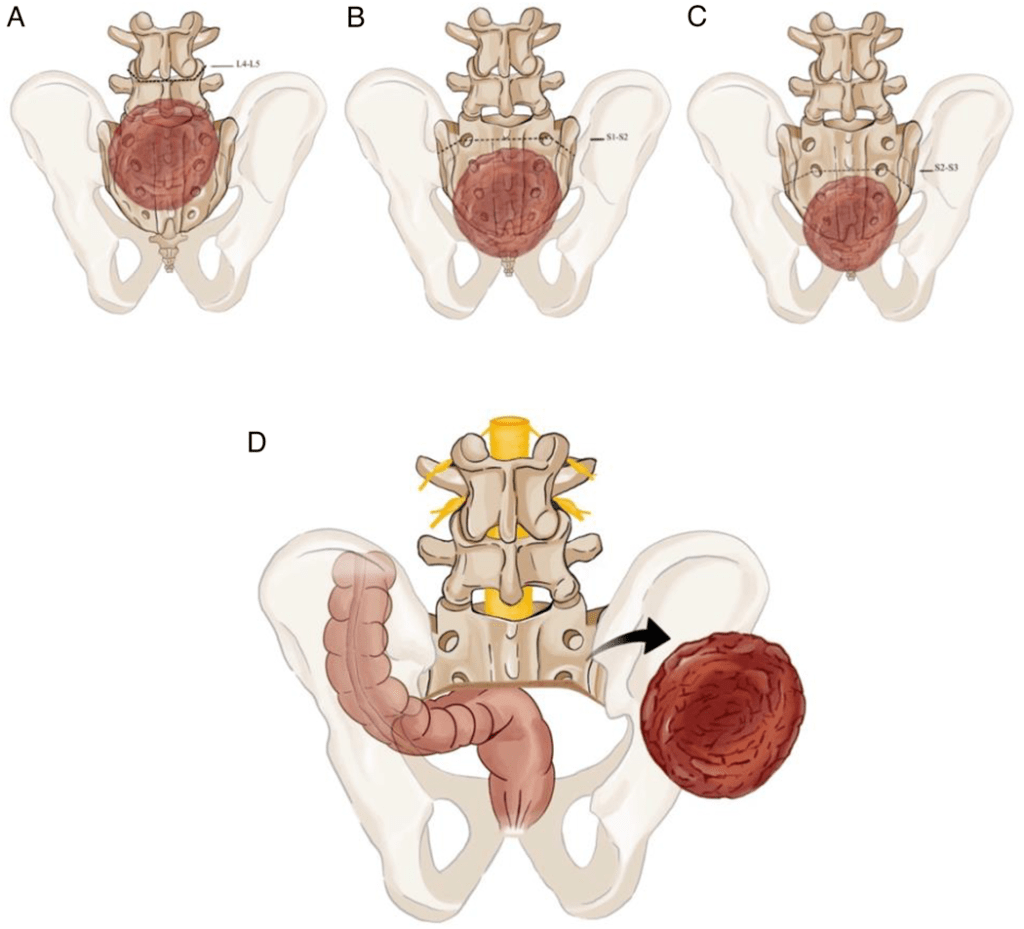 Multidisciplinary surgical considerations for en bloc resection of ...