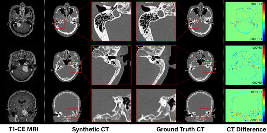 Generation and applications of synthetic computed tomography images for ...