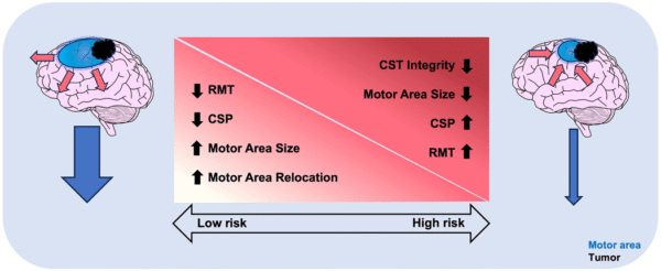 The neuronal reserve in glioma surgery: functional reorganization of ...